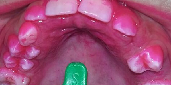 Educación Factores de Riesgo